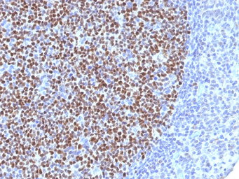 Anti-BCL6 antibody [BCL6/1527] used in IHC (Paraffin sections) (IHC-P). GTX34434