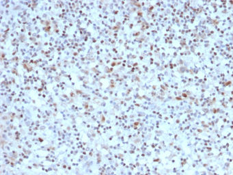 Anti-BCL6 antibody [BCL6/1527] used in IHC (Paraffin sections) (IHC-P). GTX34434