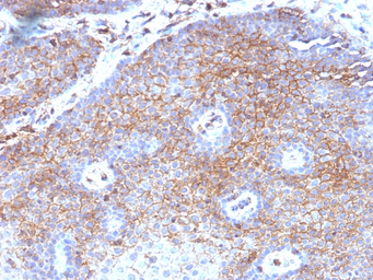 Anti-beta 2 Microglobulin antibody [B2M/1118] used in IHC (Paraffin sections) (IHC-P). GTX34435