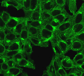 Anti-beta 2 Microglobulin antibody [SPM617] used in Immunocytochemistry/ Immunofluorescence (ICC/IF). GTX34436