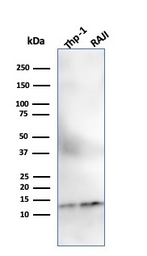 Anti-beta 2 Microglobulin antibody [SPM617] used in Western Blot (WB). GTX34436