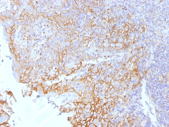 Anti-beta Catenin antibody [5H10] used in IHC (Paraffin sections) (IHC-P). GTX34440