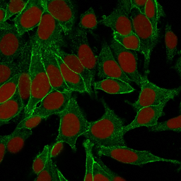 Anti-beta Catenin antibody [6F9] used in Immunocytochemistry/ Immunofluorescence (ICC/IF). GTX34441
