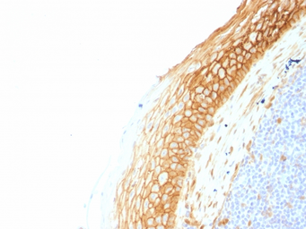 Anti-beta Catenin antibody [CTNNB1/1507] used in IHC (Paraffin sections) (IHC-P). GTX34442