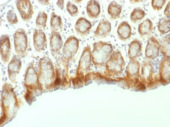 Anti-beta Catenin antibody [CTNNB1/1507] used in IHC (Paraffin sections) (IHC-P). GTX34442