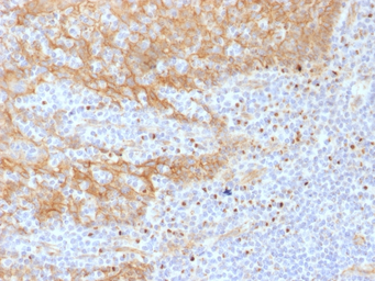 Anti-beta Catenin antibody [CTNNB1/1508] used in IHC (Paraffin sections) (IHC-P). GTX34443