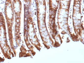 Anti-beta Catenin antibody [CTNNB1/1508] used in IHC (Paraffin sections) (IHC-P). GTX34443