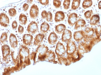 Anti-beta Catenin antibody [CTNNB1/1509] used in IHC (Paraffin sections) (IHC-P). GTX34444
