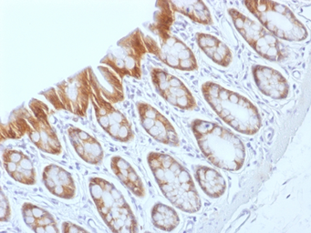 Anti-beta Catenin antibody [CTNNB1/1509] used in IHC (Paraffin sections) (IHC-P). GTX34444