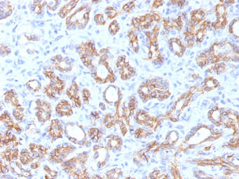 Anti-beta Catenin antibody [CTNNB1/1509] used in IHC (Paraffin sections) (IHC-P). GTX34444