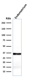 Anti-Calponin 1 antibody [rCNN1/832] used in Western Blot (WB). GTX34449
