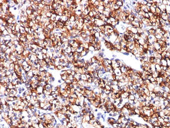 Anti-Carbonic Anhydrase IX antibody [CA9/781] used in IHC (Paraffin sections) (IHC-P). GTX34452
