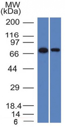 Anti-CD105 antibody [ENG/1327] used in Western Blot (WB). GTX34454