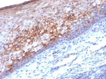 Anti-CD146 antibody [MCAM/1101] used in IHC (Paraffin sections) (IHC-P). GTX34458