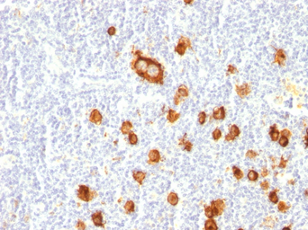 Anti-SSEA-1 / CD15 antibody [FUT4/815] used in IHC (Paraffin sections) (IHC-P). GTX34466