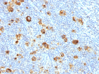 Anti-SSEA-1 / CD15 antibody [FUT4/1478R] used in IHC (Paraffin sections) (IHC-P). GTX34467