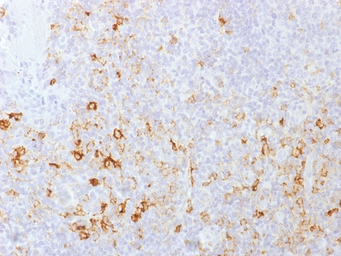 Anti-CD162 antibody [PSGL1/1601] used in IHC (Paraffin sections) (IHC-P). GTX34468