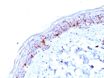 Anti-CD1a antibody [O10] used in IHC (Paraffin sections) (IHC-P). GTX34469