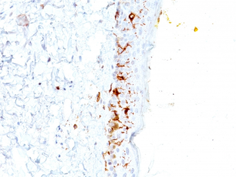 Anti-CD1a antibody [C1A/711] used in IHC (Paraffin sections) (IHC-P). GTX34471