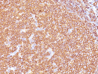 Anti-CD20 antibody [SPM618] used in IHC (Paraffin sections) (IHC-P). GTX34475