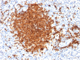 Anti-CD22 antibody [BLCAM/1795] used in IHC (Paraffin sections) (IHC-P). GTX34478