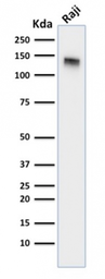 Anti-CD22 antibody [BLCAM/1795] used in Western Blot (WB). GTX34478