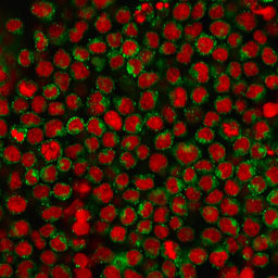 Anti-CD27 antibody [LPFS2/1611] used in Immunocytochemistry/ Immunofluorescence (ICC/IF). GTX34479