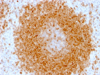 Anti-CD27 antibody [LPFS2/1611] used in IHC (Paraffin sections) (IHC-P). GTX34479