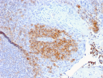 Anti-CD27 antibody [LPFS2/1611] used in IHC (Paraffin sections) (IHC-P). GTX34479