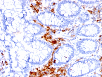 Anti-CD27 antibody [LPFS2/1611] used in IHC (Paraffin sections) (IHC-P). GTX34479