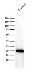 Anti-CD3 epsilon antibody [PC3/188A] used in Western Blot (WB). GTX34480