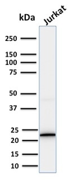 Anti-CD3 epsilon antibody [PC3/188A] used in Western Blot (WB). GTX34480