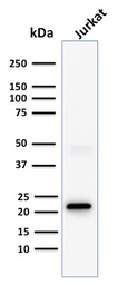 Anti-CD3 epsilon antibody [C3e/1308] used in Western Blot (WB). GTX34481