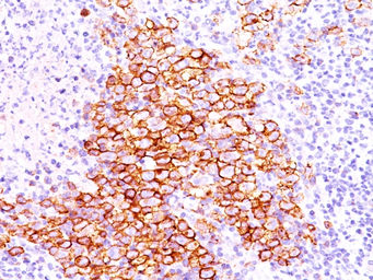 Anti-CD30 antibody [CD30/412] used in IHC (Paraffin sections) (IHC-P). GTX34483