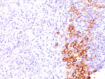 Anti-CD30 antibody [SPM609] used in IHC (Paraffin sections) (IHC-P). GTX34485