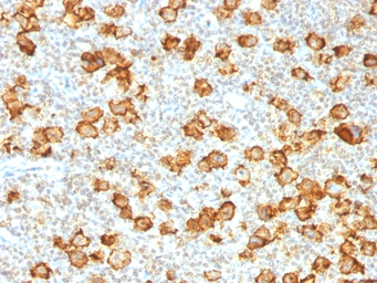 Anti-CD30 antibody [Ki-1/1505R] used in IHC (Paraffin sections) (IHC-P). GTX34487