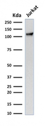 Anti-CD31 antibody [C31.7] used in Western Blot (WB). GTX34489