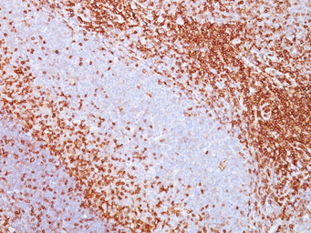 Anti-CD43 antibody [SPN/839] used in IHC (Paraffin sections) (IHC-P). GTX34508