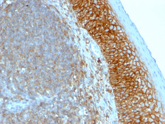 Anti-CD44 antibody [SPM544] used in IHC (Paraffin sections) (IHC-P). GTX34514