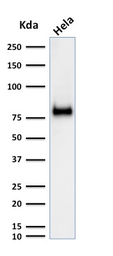 Anti-CD44 antibody [SPM521] used in Western Blot (WB). GTX34515