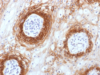 Anti-CD44v6 antibody [CD44v6/1246] used in IHC (Paraffin sections) (IHC-P). GTX34522
