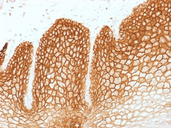 Anti-CD44v6 antibody [CD44v6/1246] used in IHC (Paraffin sections) (IHC-P). GTX34522