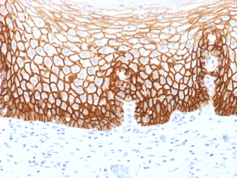 Anti-CD44v9 antibody [CD44v9/1459] used in IHC (Paraffin sections) (IHC-P). GTX34523