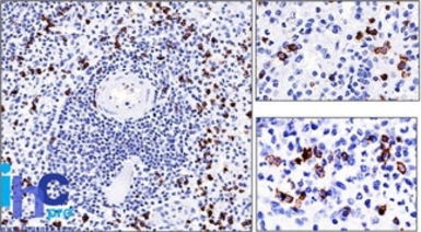 Anti-CD57 antibody [NK-1] used in IHC (Paraffin sections) (IHC-P). GTX34529