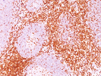 Anti-CD6 antibody [3F7B5] used in IHC (Paraffin sections) (IHC-P). GTX34535
