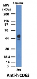 Anti-CD63 antibody [MX-49.129.5] used in Western Blot (WB). GTX34540