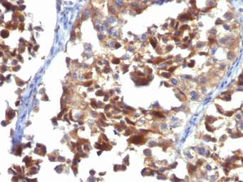 Anti-CD63 antibody [LAMP3/968] used in IHC (Paraffin sections) (IHC-P). GTX34541