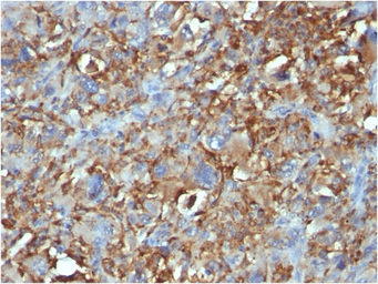Anti-CD68 antibody [C68/684] used in IHC (Paraffin sections) (IHC-P). GTX34544