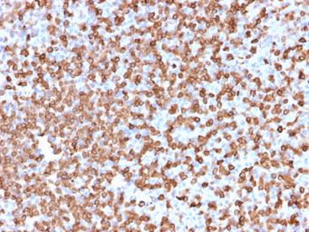 Anti-CD74 antibody [LN-2] used in IHC (Paraffin sections) (IHC-P). GTX34551