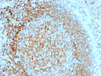 Anti-CD74 antibody [LN-2] used in IHC (Paraffin sections) (IHC-P). GTX34551